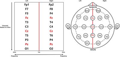 Novel quantitative electroencephalogram feature image adapted for deep learning: Verification through classification of Alzheimer’s disease dementia